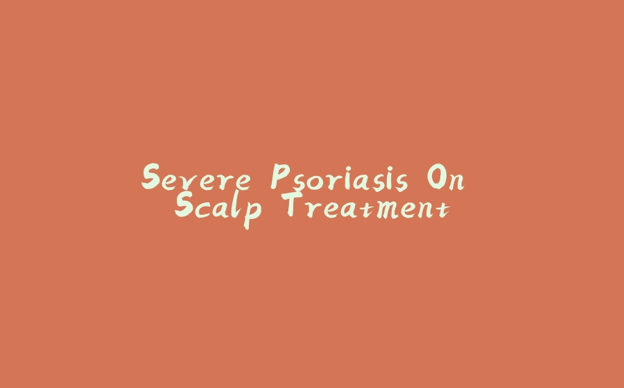 Severe Psoriasis On Scalp Treatment - 拾光赋-拾光赋